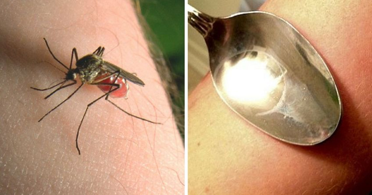 best way to stop mosquito bite itch